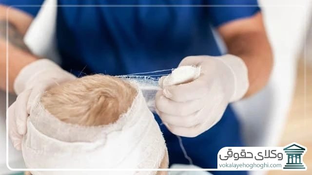 دیه شکستگی سر در سال 1405